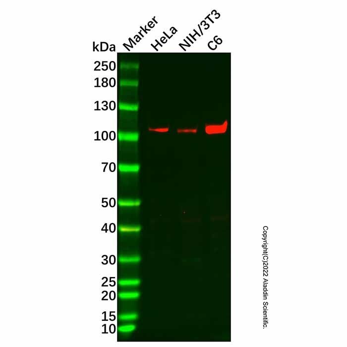 Recombinant CD10 Antibody -    by Aladdin Scientific