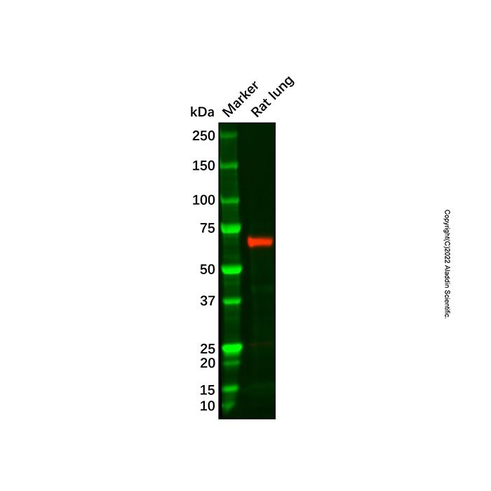 Recombinant CD105 Antibody -    by Aladdin Scientific