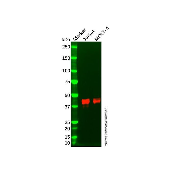 Recombinant CD1c Antibody -    by Aladdin Scientific