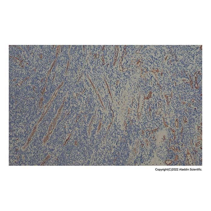 Recombinant CD34 Antibody -    by Aladdin Scientific