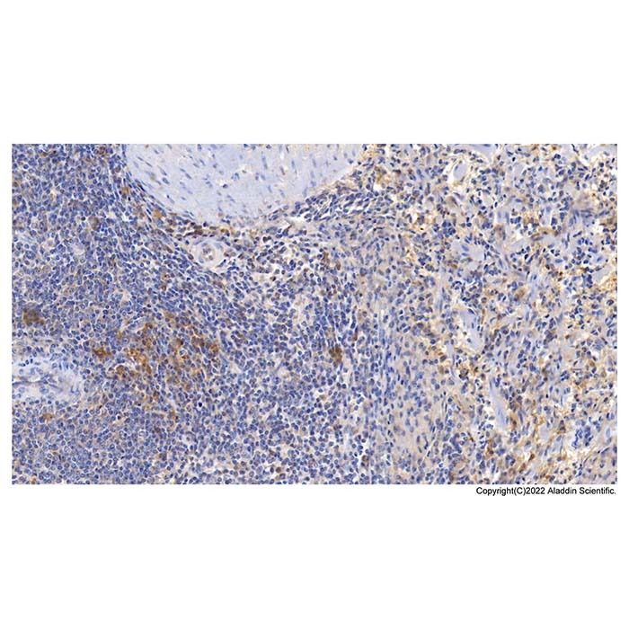 CD3D Mouse mAb -    by Aladdin Scientific