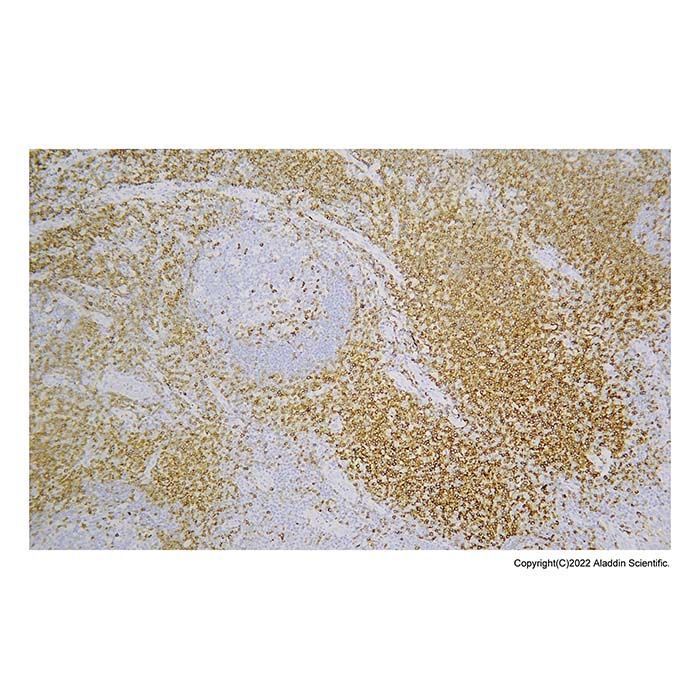 Recombinant CD5 Antibody -    by Aladdin Scientific