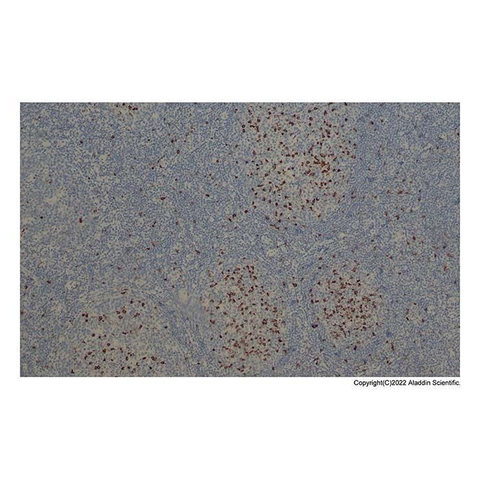 Recombinant CD57 Antibody -    by Aladdin Scientific