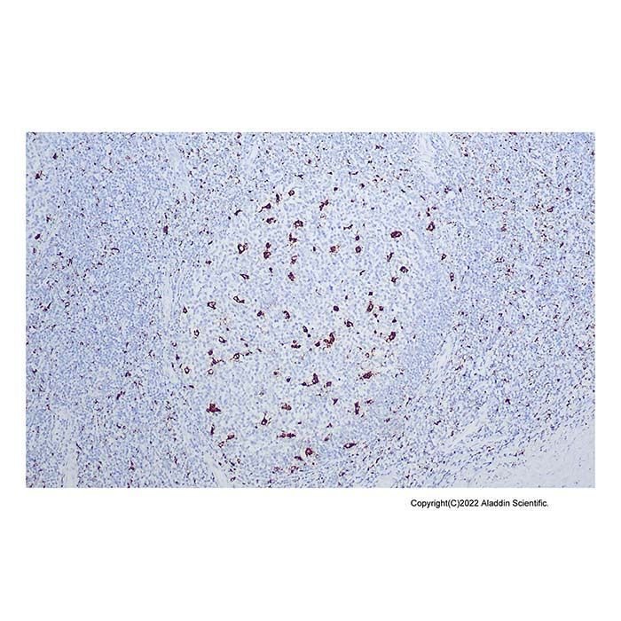 Recombinant CD68 Antibody -    by Aladdin Scientific