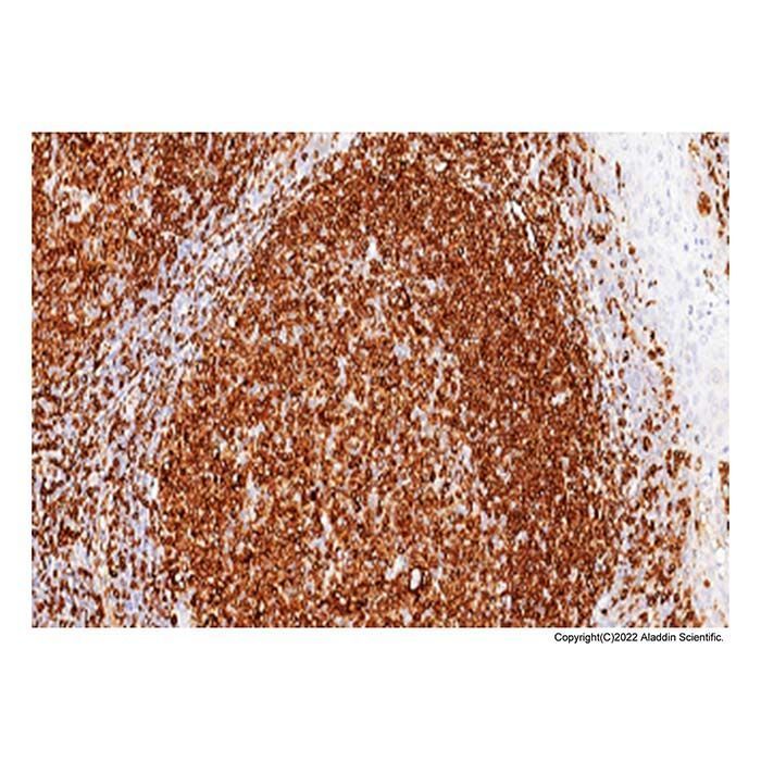 Recombinant CD74 Antibody -    by Aladdin Scientific