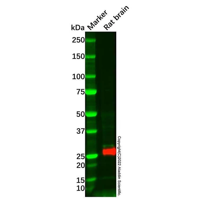 Recombinant CD90/Thy1 Antibody -    by Aladdin Scientific