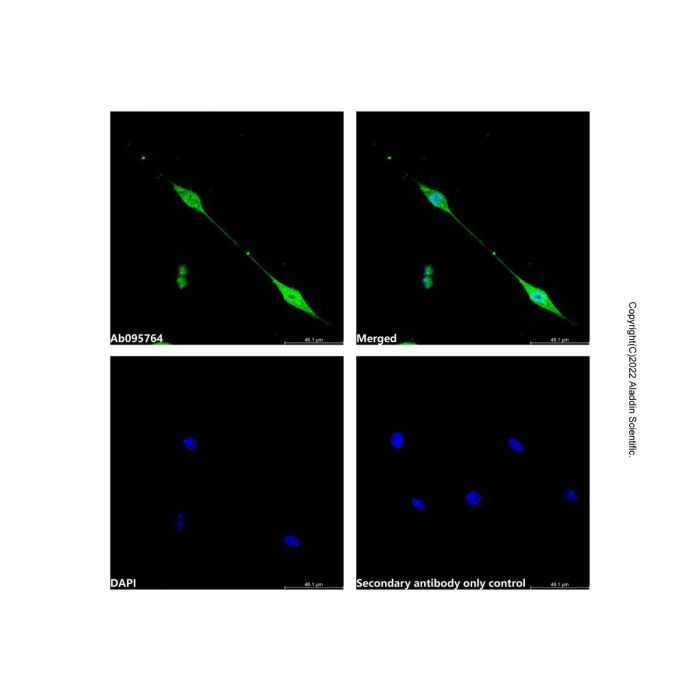 Cdk4 Antibody - by Aladdin Scientific