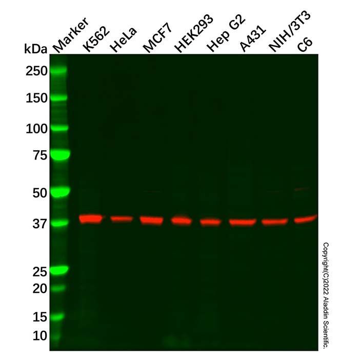 Recombinant Cdk9 Antibody -    by Aladdin Scientific