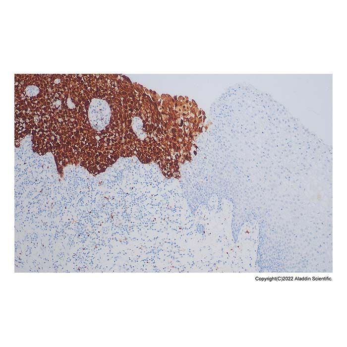 Recombinant CDKN2A/p16INK4a Antibody -    by Aladdin Scientific