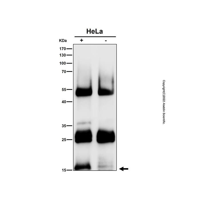 Recombinant CDKN2A/p16INK4a Antibody -    by Aladdin Scientific