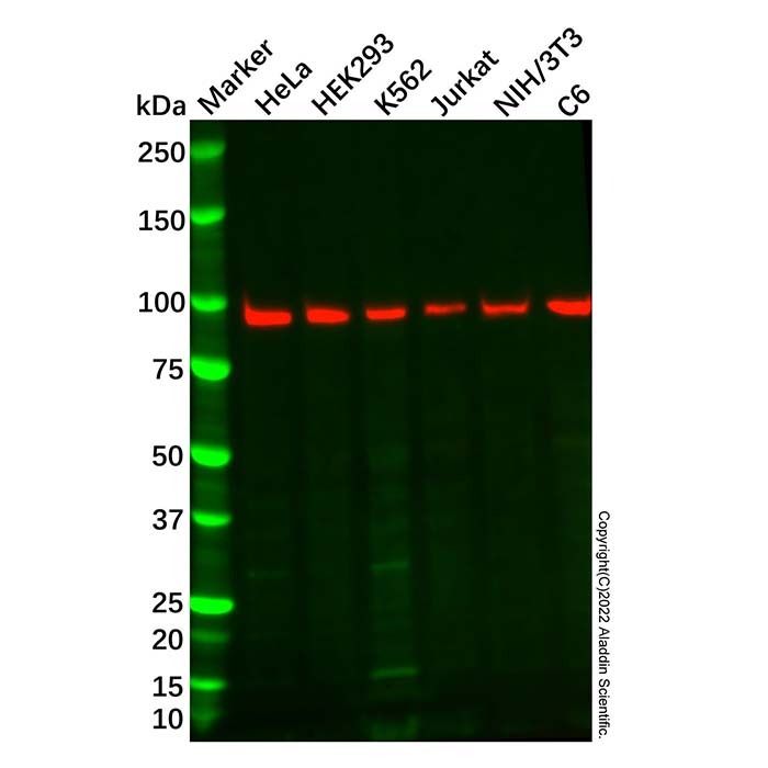 Recombinant CDT2/RAMP Antibody -    by Aladdin Scientific