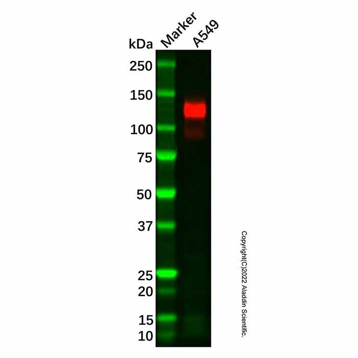 Recombinant CEACAM1 Antibody -    by Aladdin Scientific