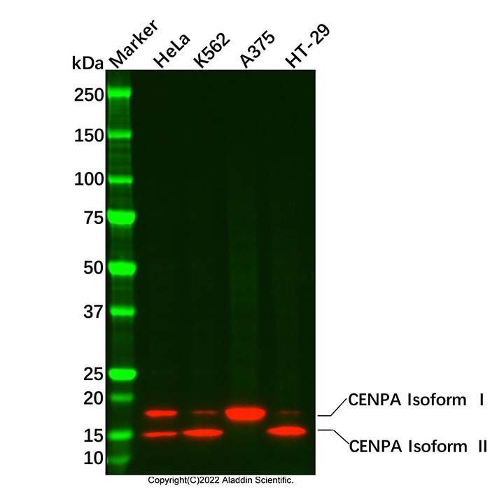 Recombinant CENPA Antibody -    by Aladdin Scientific