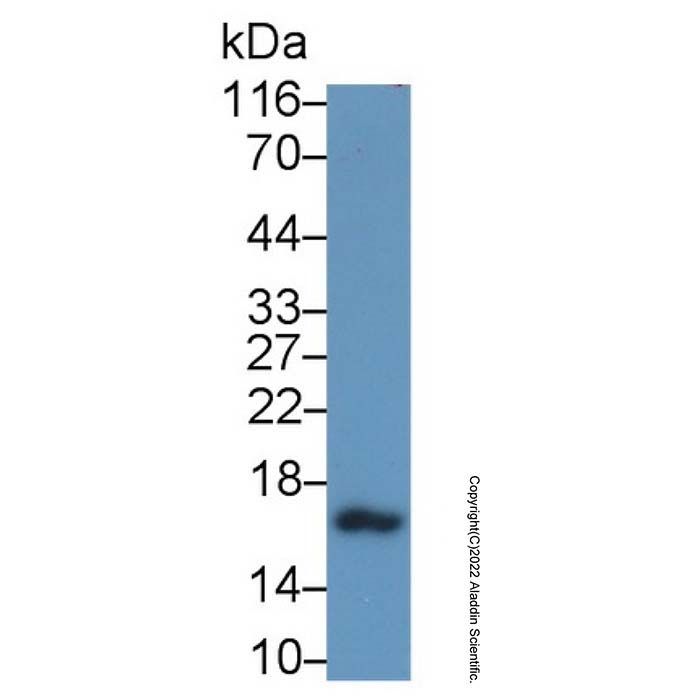 Calcitonin/CALCA Antibody -    by Aladdin Scientific