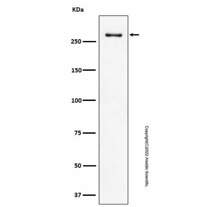 Recombinant CHD3 Antibody -    by Aladdin Scientific