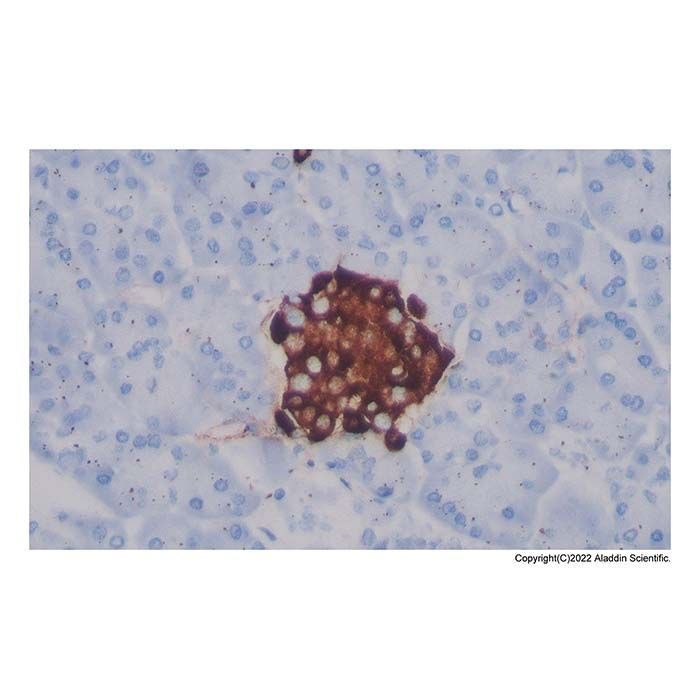Recombinant Chromogranin A Antibody -    by Aladdin Scientific