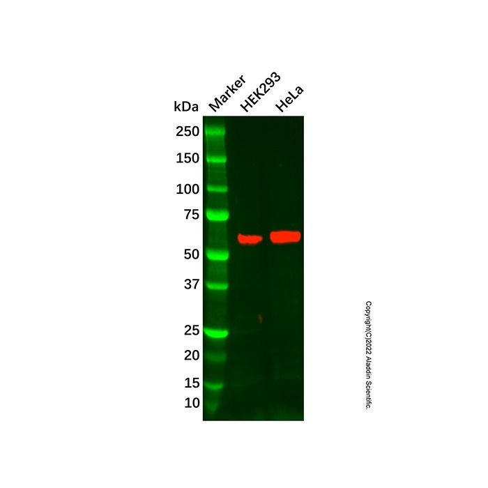 CHST3 Antibody -    by Aladdin Scientific
