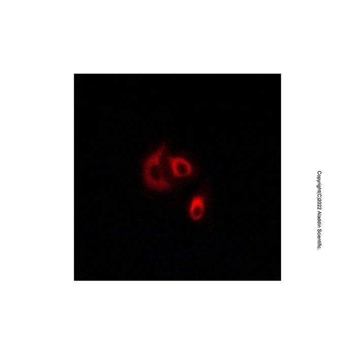 CLCC1 Antibody -    by Aladdin Scientific