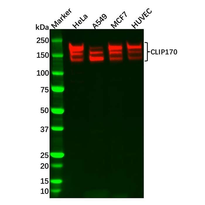 Recombinant CLIP170 Antibody -    by Aladdin Scientific