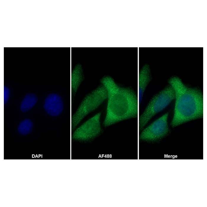 Cofilin 1 Mouse mAb -    by Aladdin Scientific