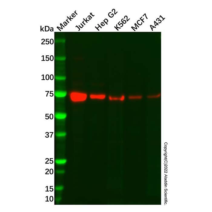 Recombinant Coilin Antibody -    by Aladdin Scientific