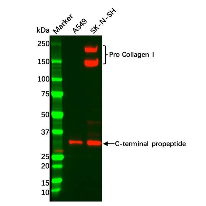 Collagen I Antibody - by Aladdin Scientific