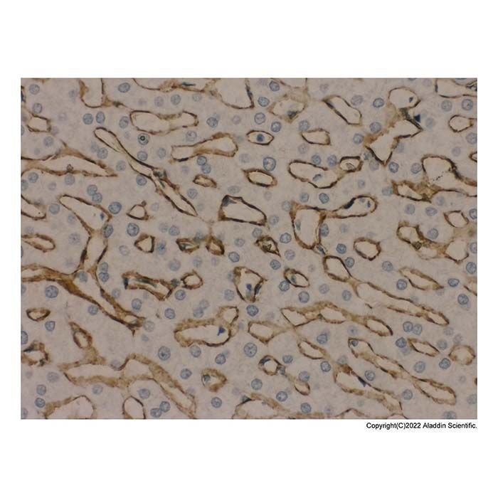 Recombinant Collagen IV Antibody - by Aladdin Scientific