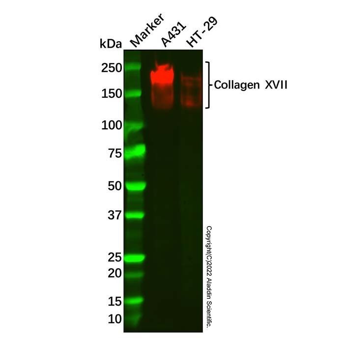 Recombinant Collagen XVII Antibody -    by Aladdin Scientific