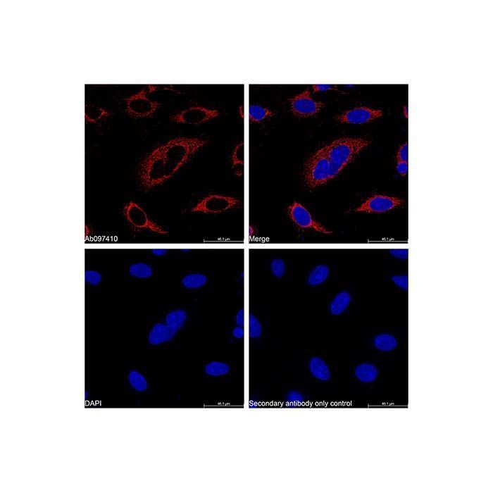 Recombinant COX IV Antibody - by Aladdin Scientific