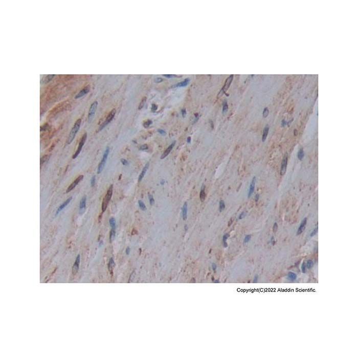 COX1/Cyclooxygenase 1 Antibody -    by Aladdin Scientific