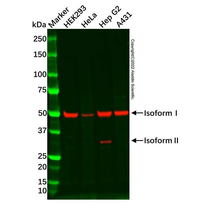 Coxsackie Adenovirus Receptor/hCAR Antibody -    by Aladdin Scientific