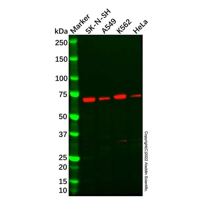 Recombinant CPEB1 Antibody -    by Aladdin Scientific
