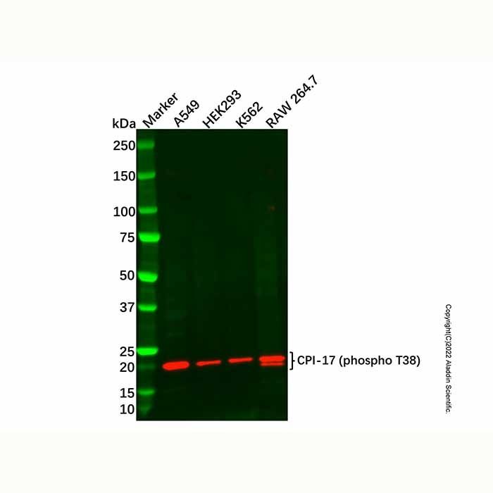 CPI-17 (phospho T38) Antibody -    by Aladdin Scientific