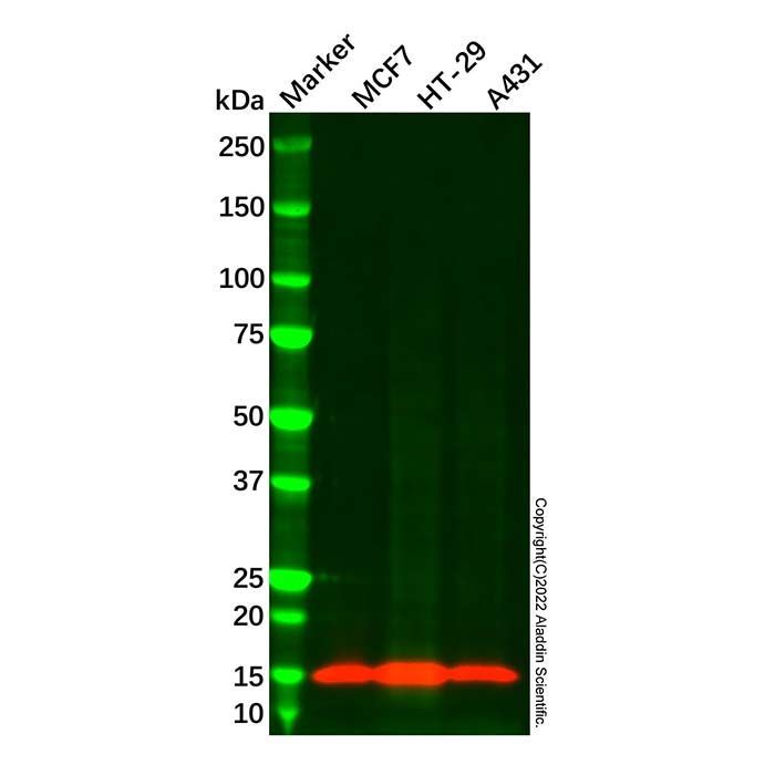 CRABP2 Mouse mAb -    by Aladdin Scientific