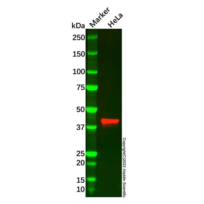 Creatine Kinase MM Mouse mAb - by Aladdin Scientific