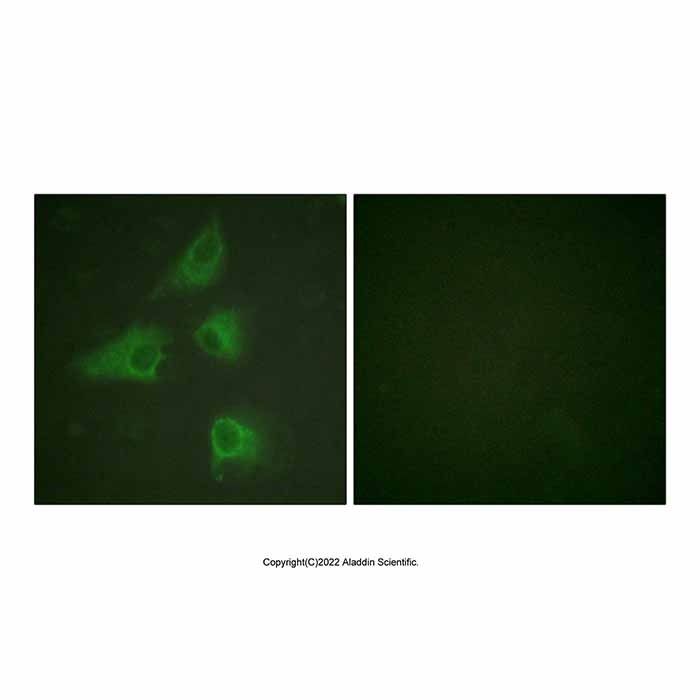 CRMP2 Antibody -    by Aladdin Scientific