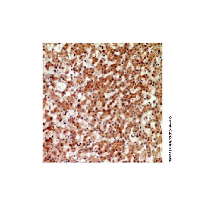 CRTH2 Antibody -    by Aladdin Scientific
