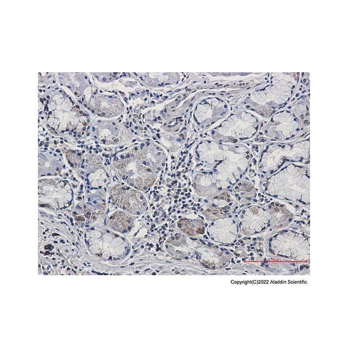 Recombinant CSDE1/NRU Antibody -    by Aladdin Scientific