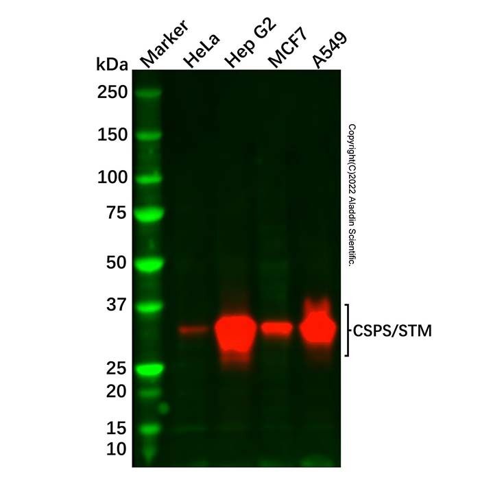 Recombinant CSPS/STM Antibody -    by Aladdin Scientific
