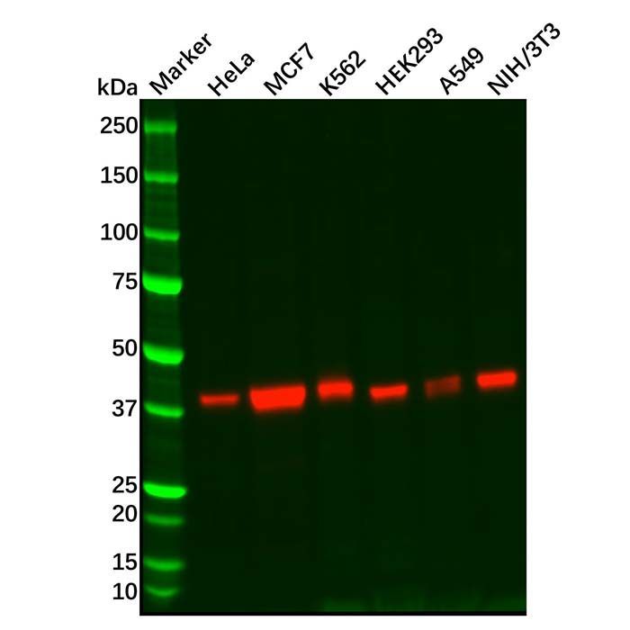 Recombinant CT A Antibody -    by Aladdin Scientific