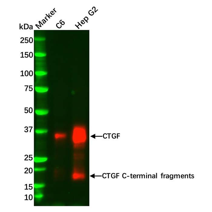 Recombinant CTGF Antibody -    by Aladdin Scientific