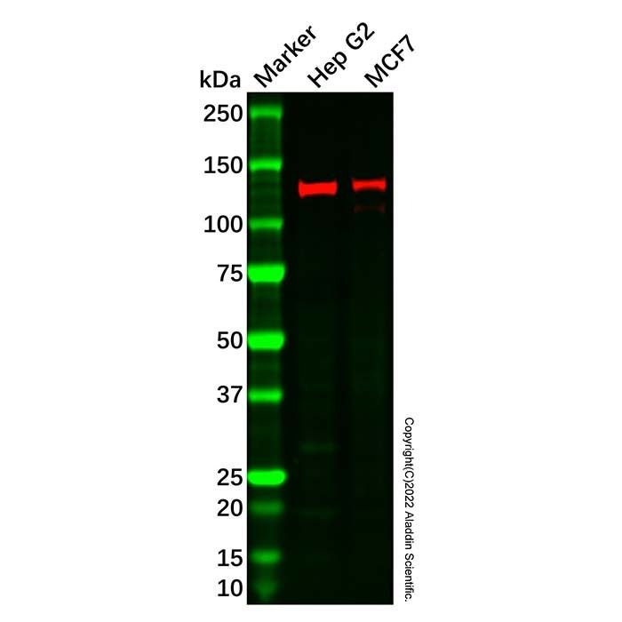 Recombinant Ctip2 Antibody -    by Aladdin Scientific