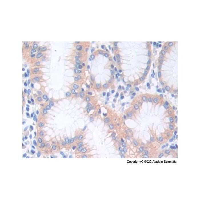 CTNNA1 Antibody -    by Aladdin Scientific