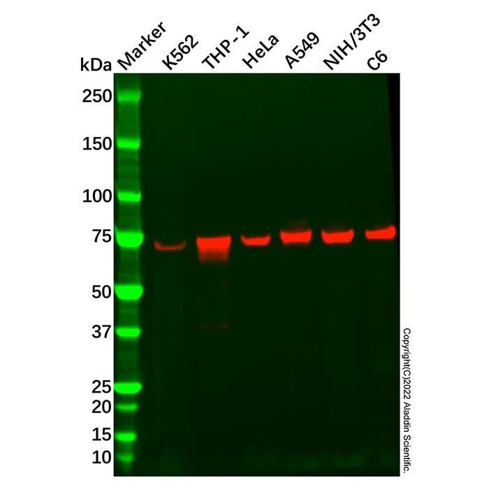 Recombinant CTP synthase/CTPS Antibody -    by Aladdin Scientific