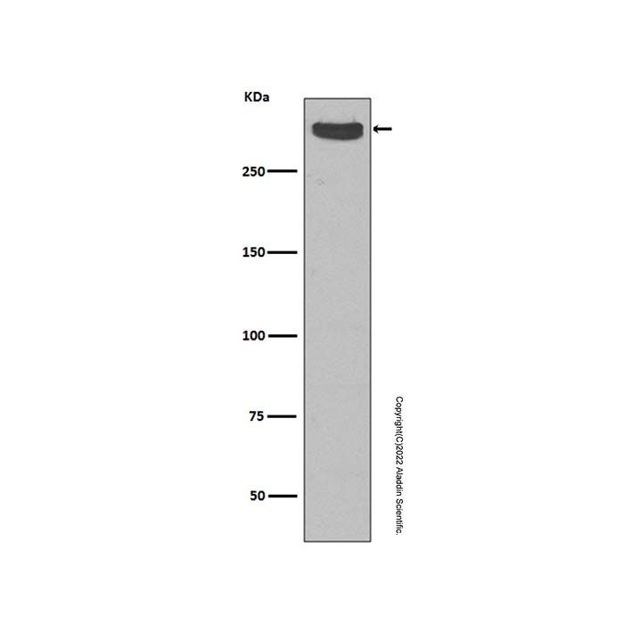 Recombinant Cubilin Antibody -    by Aladdin Scientific