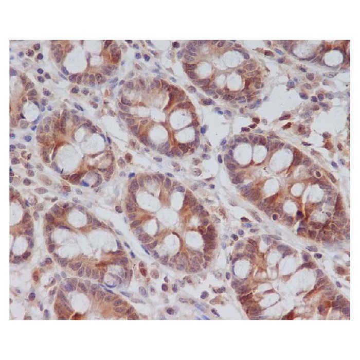 Recombinant Cyclin B2/CCNB2 Antibody -    by Aladdin Scientific