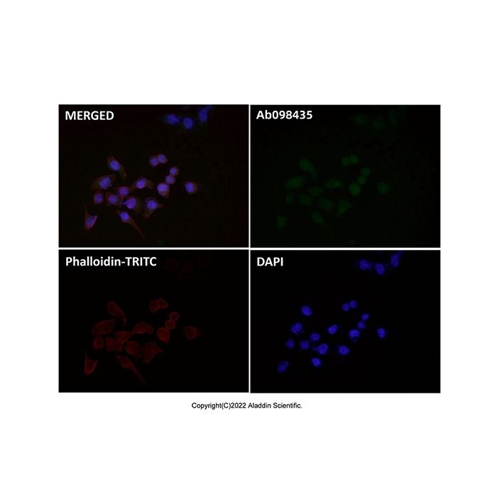 Recombinant Cyclin D1 Antibody -    by Aladdin Scientific