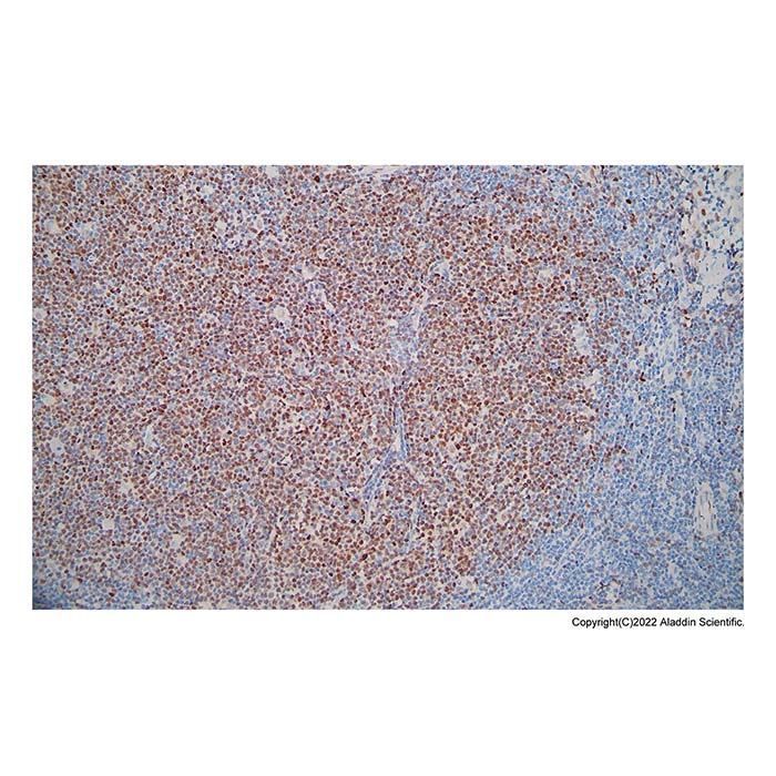 Recombinant Cyclin D1 Antibody -    by Aladdin Scientific