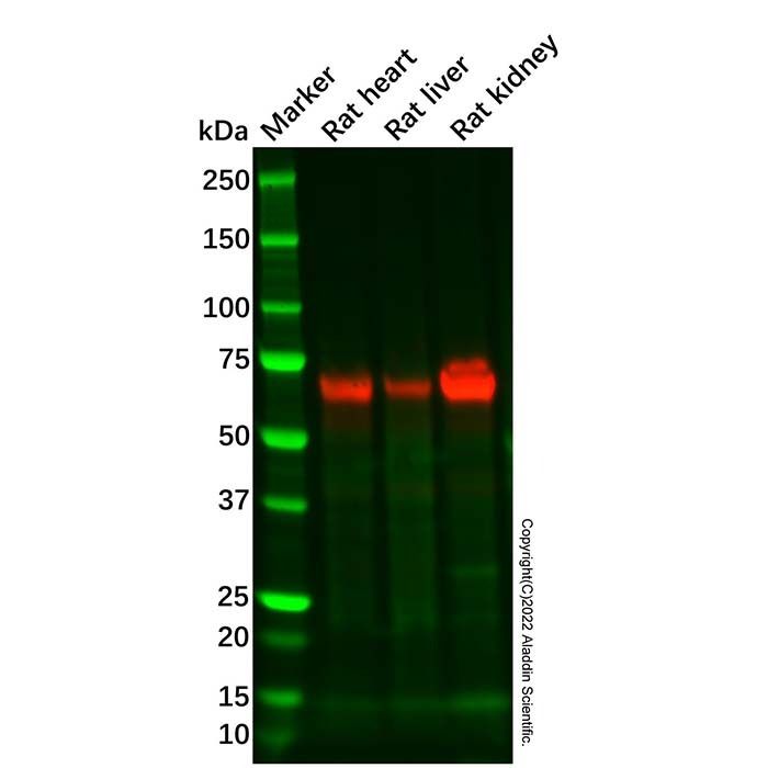 Recombinant CYP1B1 Antibody -    by Aladdin Scientific