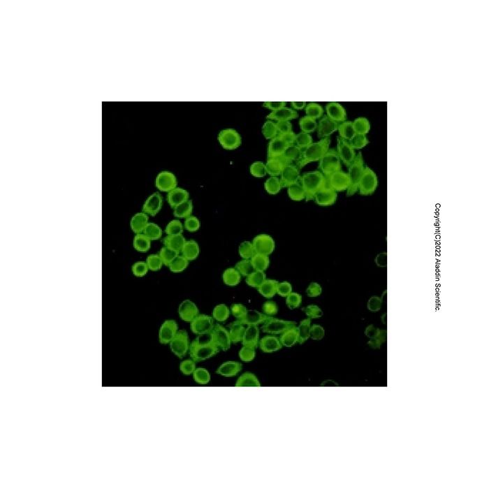 Recombinant CYP2D6 Antibody -    by Aladdin Scientific